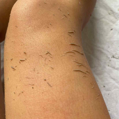 GLADIA rękawica do peelingu ciała (Anti-Ingrown)