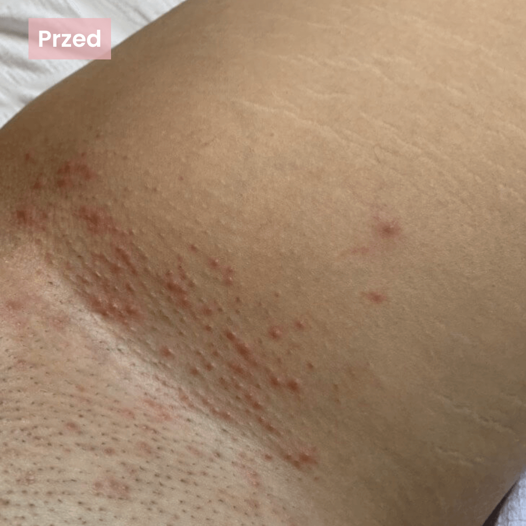 Delikatnie dla skóry.