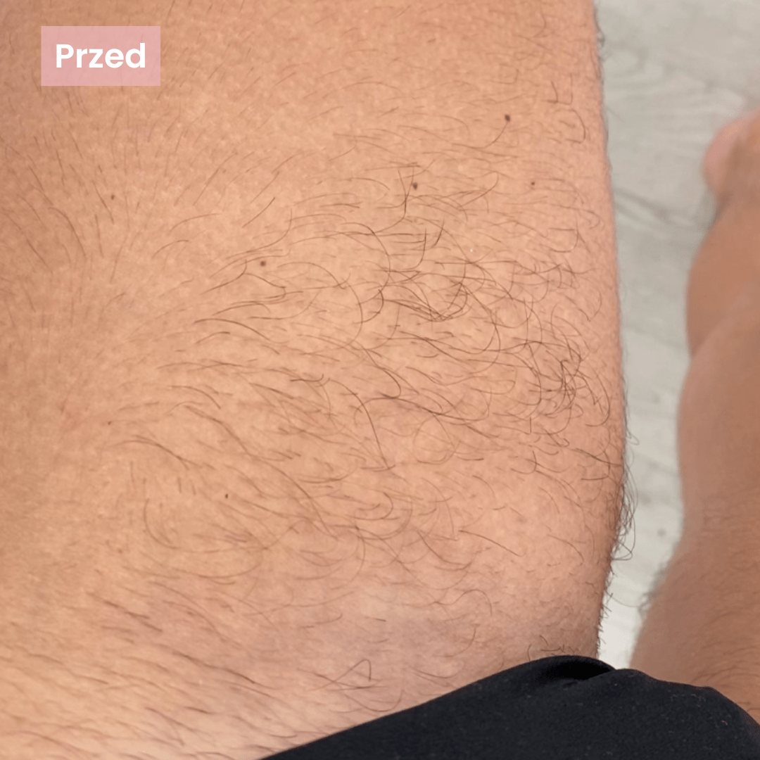 Skutecznie dla włosków.