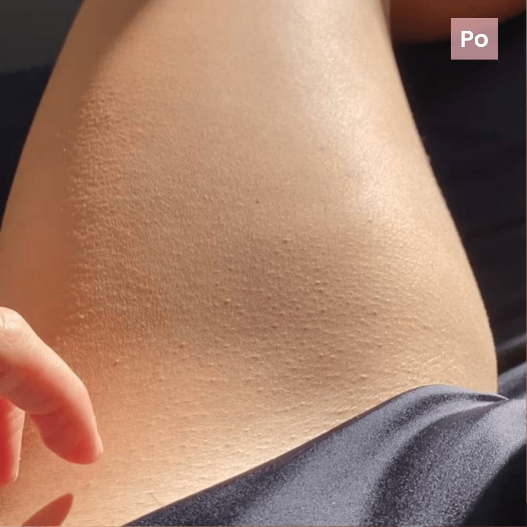 Skutecznie dla włosków.