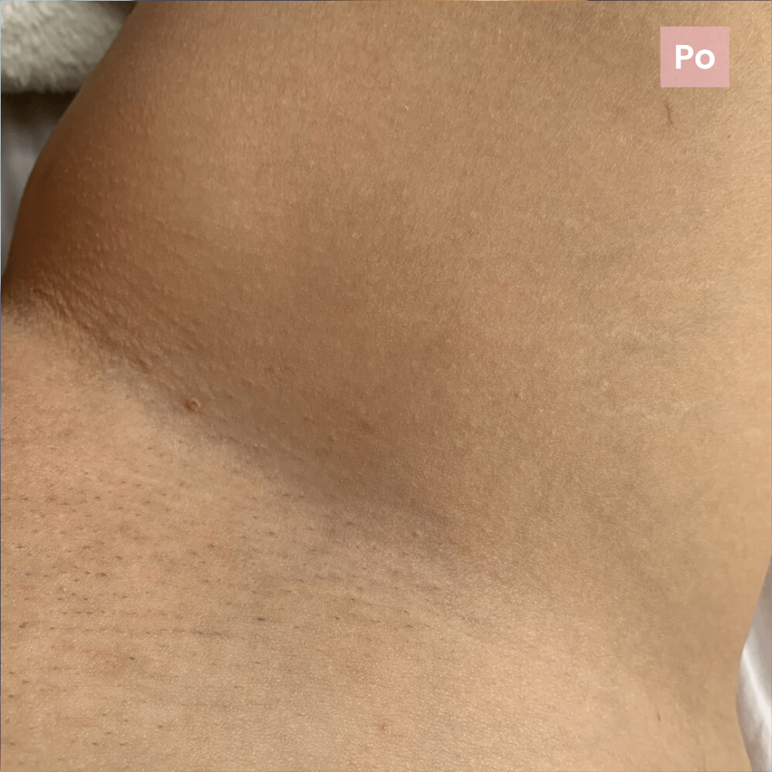 Delikatnie dla skóry.